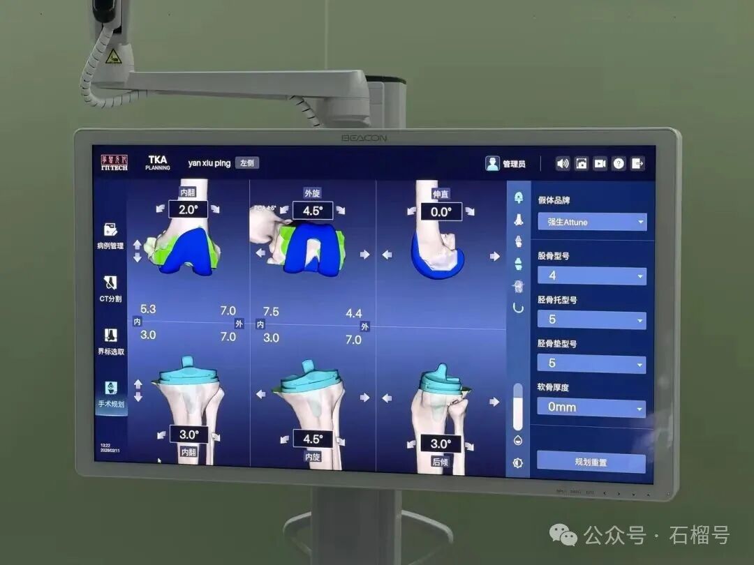 微信圖片_2026-02-13_221310_394.jpg 微信圖片_2026-02-13_221310_394.jpg